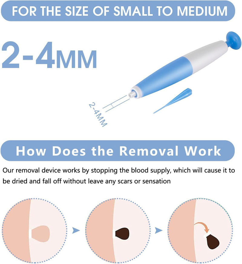 Skin Tag Removal Kit (More than 33,000 Happy Customers)