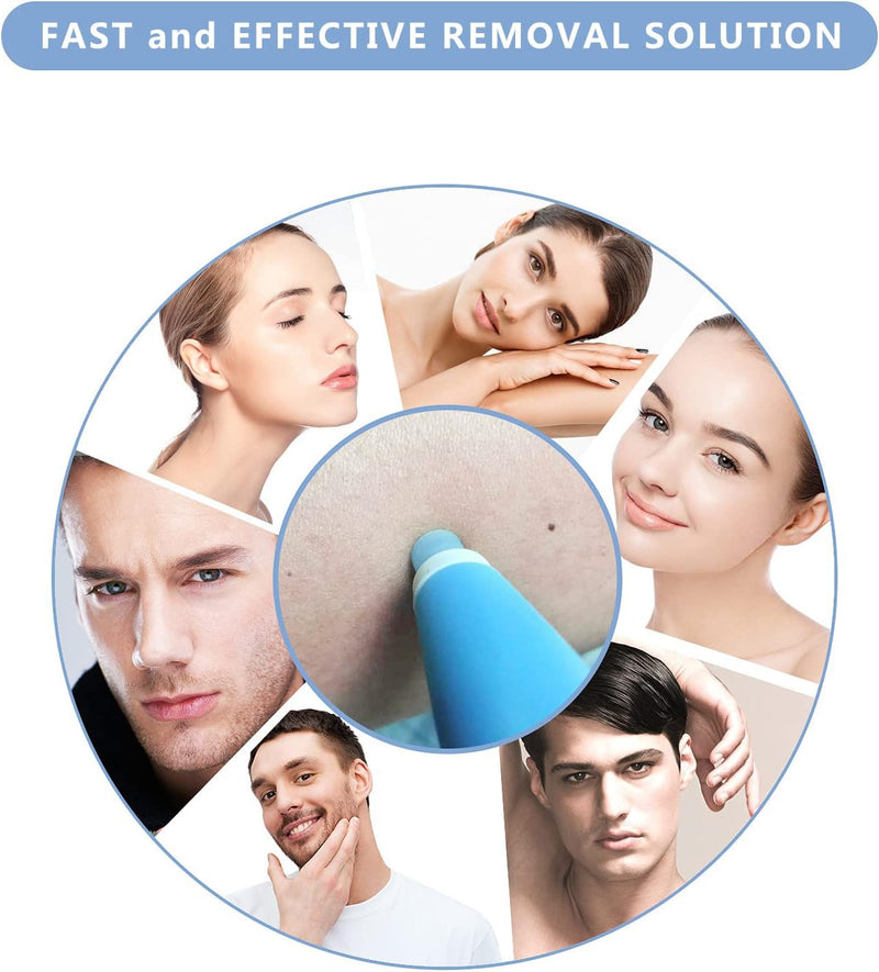 Skin Tag Removal Kit (More than 33,000 Happy Customers)