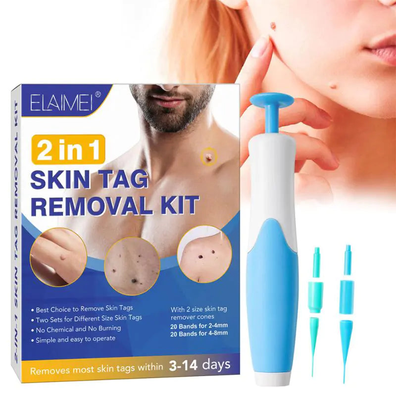 Skin Tag Removal Kit (More than 33,000 Happy Customers)