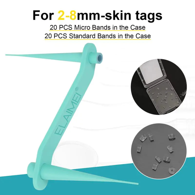 Skin Tag Removal Kit (More than 33,000 Happy Customers)